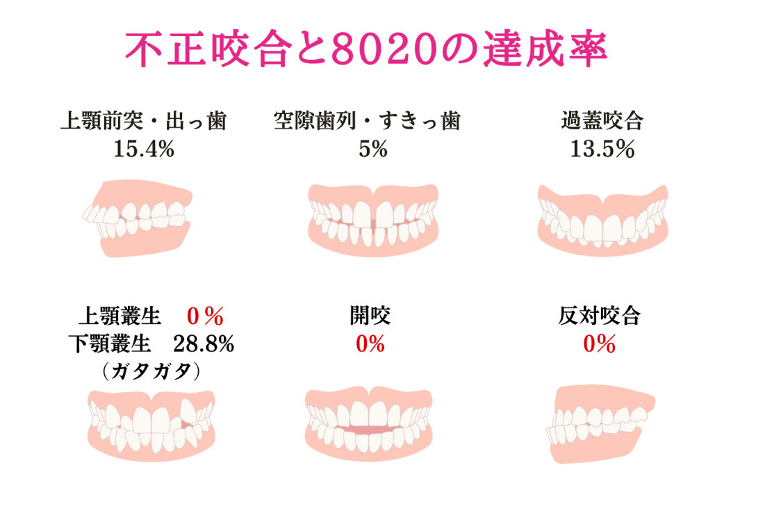 マウスピース矯正